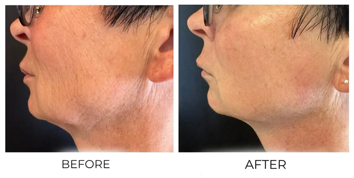 Face & Neck